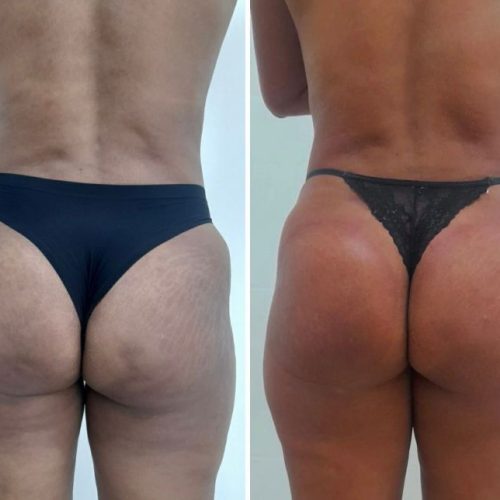 WhatsApp Image 2023-05-16 at 11.15.09