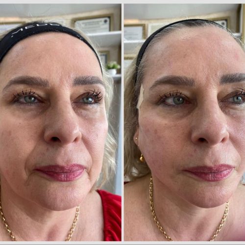 WhatsApp Image 2023-05-16 at 11.17.47